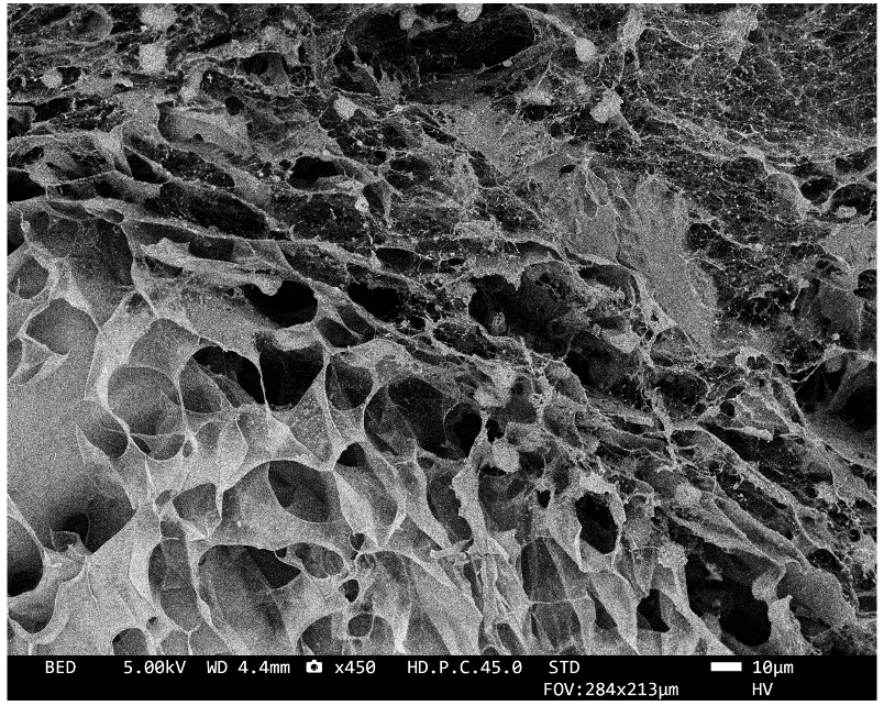Decellularized extracellular matrix