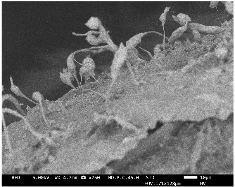 Cancer cells in dECM