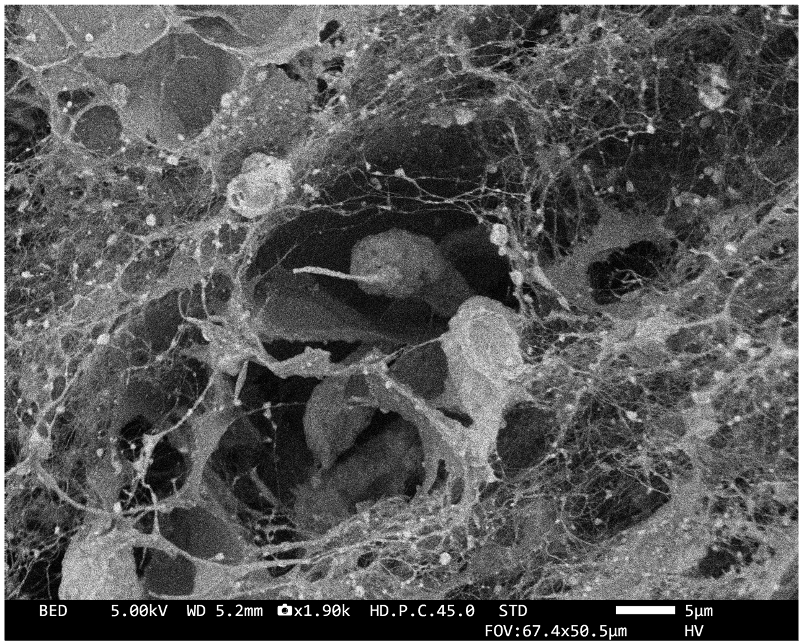 MDA-MB-231 breast cancer cells in dECM
