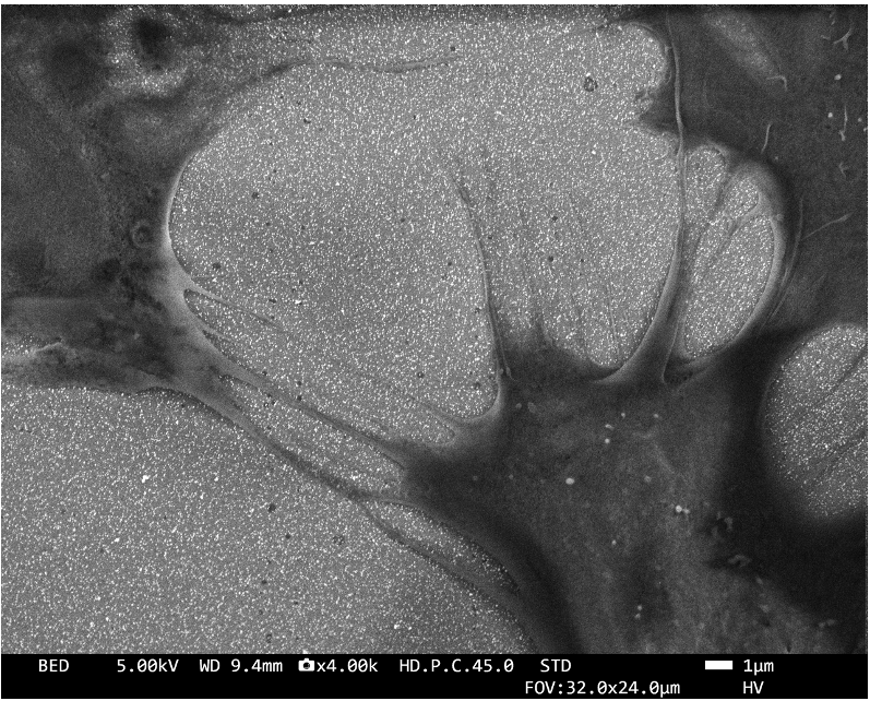 SH-SY5Y neuroblastoma cells on gold nanostars