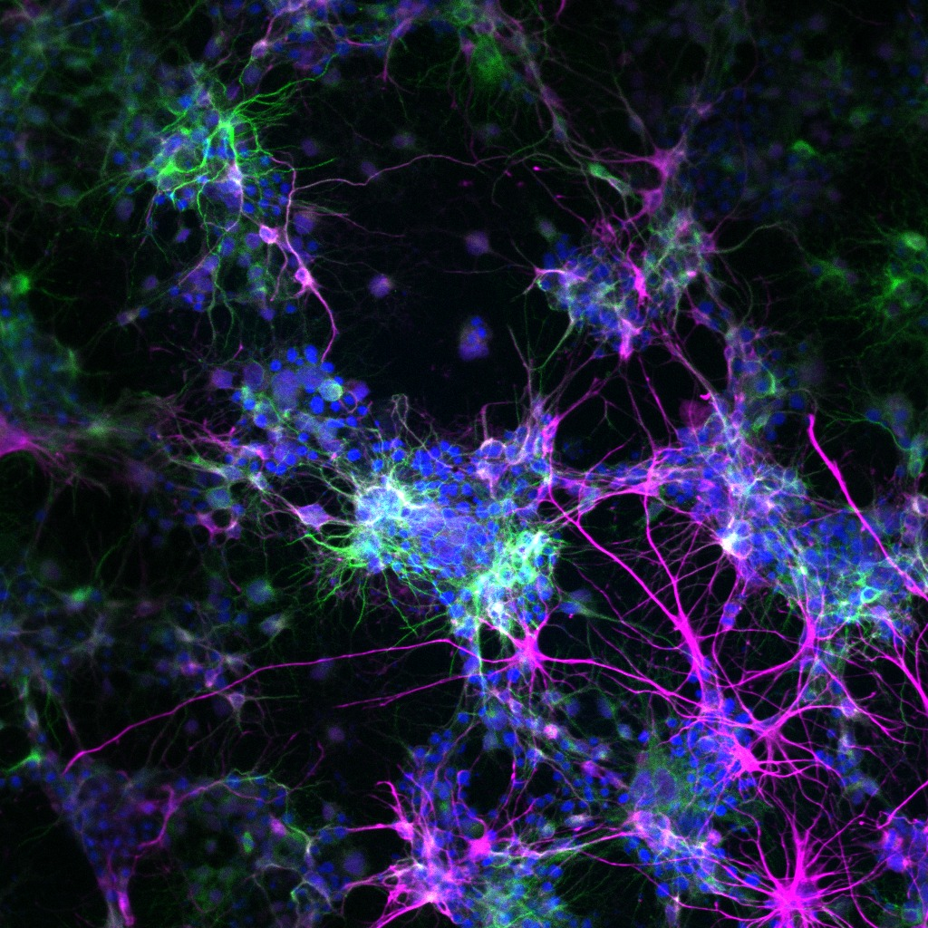Plasmonic Nanoparticles Research